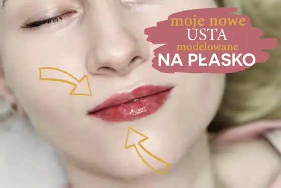 Ile kosztuje 1 ml kwasu hialuronowego w usta? Sprawdź ceny w Polsce